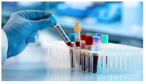 Optimization of Diagnostic Laboratory Testing