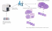 Deep Learning-Based Morphological Classification between Classical Hodgkin Lymphoma and Anaplastic Large Cell Lymphoma: A Proof of Concept and Literature Review