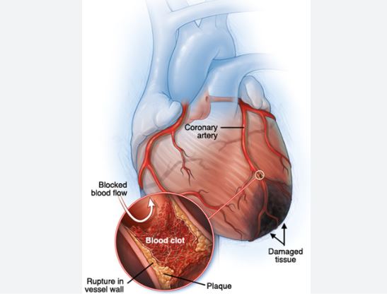 Short Commentary on the Kuznetsov et al. “The Role of Mitochondria in the Mechanisms of Cardiac Ischemia-Reperfusion Injury”